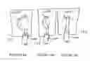 Fig. 16 - Surgical support structure