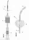Fig. 06 - Method and device for removing an occlusion