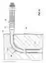 Fig. 10 - Method and device for removing an occlusion