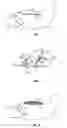 Fig. 02 - Tissue harvesting device and method