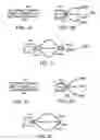 Fig. 03 - Medical retrieval device