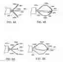 Fig. 04 - Medical retrieval device