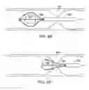 Fig. 07 - Medical retrieval device