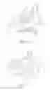 Fig. 09 - Balloon Catheters and Methods for Treating Paranasal Sinuses