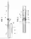 Fig. 02 - Stent delivery system to improve placement accuracy for self-expanding stent