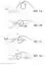 Fig. 09 - Self-looping suture and method of using the same