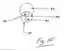 Fig. 12 - Apparatus for use in the prophylaxis or treatment of tissue