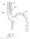 Fig. 13 - Apparatus for use in the prophylaxis or treatment of tissue