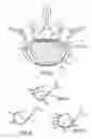 Fig. 05 - Combination electrical stimulating and infusion medical device