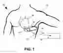 Fig. 02 - Method and apparatus for controlling arrhythmia detection and treatment based on patient posture