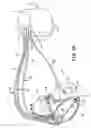 Fig. 03 - Method and apparatus for determining excitation-physiologic response delays