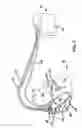 Fig. 02 - Method and system for controlling pulmonary capillary pressure