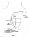 Fig. 07 - Method and apparatus for optimizing stroke volume during DDD resynchronization therapy using adjustable atrio-ventricular delays