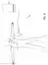 Fig. 09 - Method and apparatus for optimizing stroke volume during DDD resynchronization therapy using adjustable atrio-ventricular delays