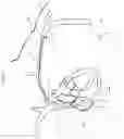 Fig. 20 - Intravascular medical device