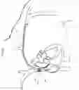 Fig. 23 - Intravascular medical device