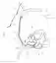 Fig. 20 - Intravascular medical device