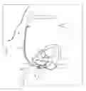 Fig. 23 - Intravascular medical device