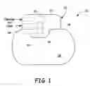Fig. 02 - Electrical interconnection structures and method