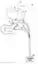 Fig. 01 - Gastrointestinal methods and apparatus for use in treating disorders