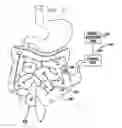 Fig. 10 - Gastrointestinal methods and apparatus for use in treating disorders