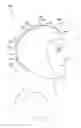 Fig. 22 - Wearable device and method for providing phototherapy to the brain