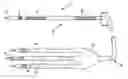 Fig. 01 - Medical electrical lead having improved inductance