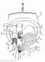 Fig. 04 - Medical electrical lead having improved inductance