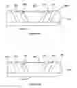Fig. 05 - Multipolar stimulation electrode with mating structures for gripping targeted tissue