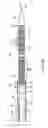 Fig. 03 - Apparatus and methods for deployment of custom-length prostheses