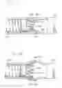 Fig. 14 - INTRALUMINAL GRAFTING SYSTEM