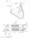 Fig. 16 - INTRALUMINAL GRAFTING SYSTEM