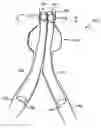 Fig. 01 - Stent graft including expandable cuff