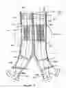 Fig. 04 - Stent graft including expandable cuff