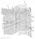 Fig. 01 - Methods and apparatus for stenting comprising enhanced embolic protection coupled with improved protections against restenosis and thrombus formation