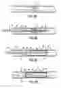 Fig. 09 - Methods and apparatus for stenting comprising enhanced embolic protection coupled with improved protections against restenosis and thrombus formation