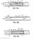 Fig. 10 - Methods and apparatus for stenting comprising enhanced embolic protection coupled with improved protections against restenosis and thrombus formation