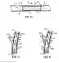 Fig. 11 - Methods and apparatus for stenting comprising enhanced embolic protection coupled with improved protections against restenosis and thrombus formation