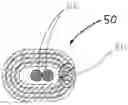 Fig. 01 - Heatset annuloplasty suture guide