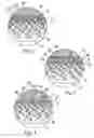 Fig. 03 - Cartilage resurfacing implant