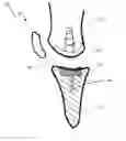 Fig. 01 - SYSTEM AND METHOD FOR ARTICULAR SURFACE REPAIR