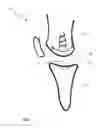 Fig. 02 - SYSTEM AND METHOD FOR ARTICULAR SURFACE REPAIR