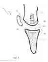 Fig. 04 - SYSTEM AND METHOD FOR ARTICULAR SURFACE REPAIR