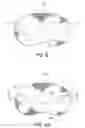 Fig. 07 - METHODS AND DEVICES FOR REPLACEMENT OF INTERVERTEBRAL DISCS