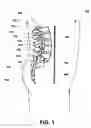 Fig. 02 - Passive lubricating prosthetic joint