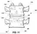 Fig. 09 - Intervertebral prosthetic disc and method of installing same