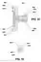 Fig. 30 - Intervertebral prosthetic disc and method of installing same