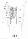 Fig. 02 - Intervertebral prosthetic disc
