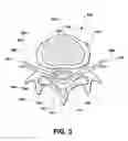 Fig. 04 - Intervertebral prosthetic disc