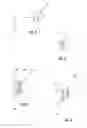 Fig. 03 - PROSTHETIC WIDE RANGE MOTION FACETS AND METHODS OF FABRICATING SAME